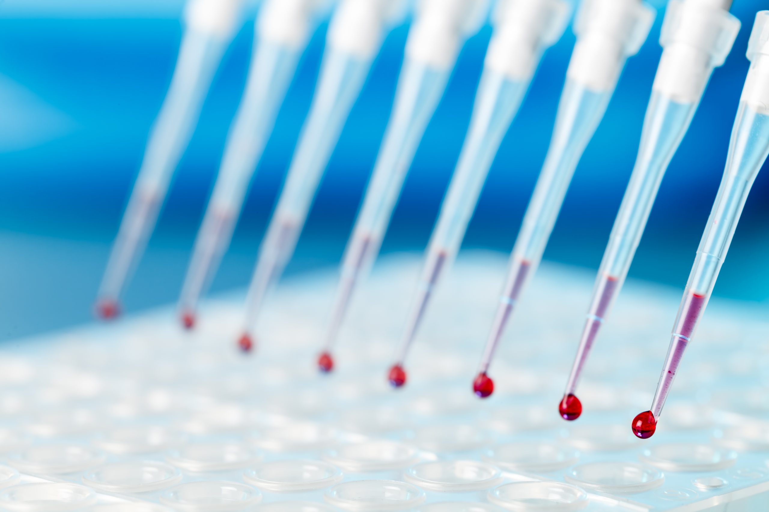 Bill Gates’ donation and awareness month help boost Alzheimer’s research