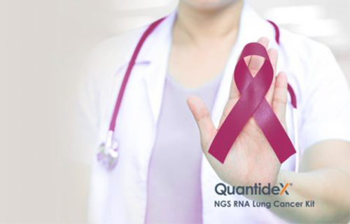 Multisite evaluation of the Asuragen NGS RNA Lung Cancer Kit demonstrates the assay’s superior performance